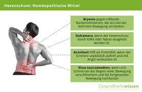 Hexenschuss Herkunft Symptome Behandlung