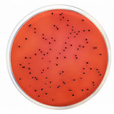 Above picture is showing growth of salmonella typhi and salmonella paratyphi on xld agar left to right respectively. Xld Agar Xylose Lysine Desoxycholate Agar Iso Formato 500 G