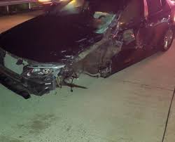 See the related link entitled shoulder injury claim to see different types of shoulder injury and how much compensation you can claim for each. Case Results