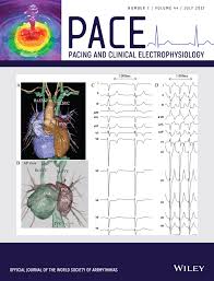 Consists of 34 apartments, 29 of which are leased. Pacing And Clinical Electrophysiology Wiley Online Library