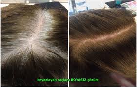 Cogumuzun Ortak Sorunu Beyazlayan Saclar Ozellikle Hanimlar Bu Konuda Cok Dertli Ve En Buyuk Soru Sac Sac Stilleri Sac Ve Guzellik