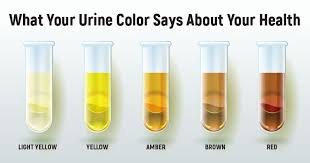 Jika banyak minum air putih, urine akan menjadi jernih karena diencerkan. 7 Jenis Warna Urine Dan Artinya Bagi Kesehatan Idn Medis