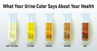 Warna air seni kuning terang. 7 Jenis Warna Urine Dan Artinya Bagi Kesehatan Idn Medis