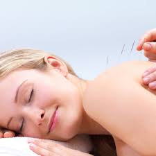 TOP 10 BEST Acupuncture in Lewisville, TX