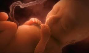 Air Pollution Harm To Unborn Babies May Be Global Health Catastrophe Warn Doctors Air Pollution The Guardian