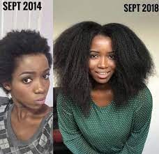 Pin By Nita R On Hair Growth Journey Natural Curls Hairstyles Hair Follicle Treatment Beautiful Natural Black Hair
