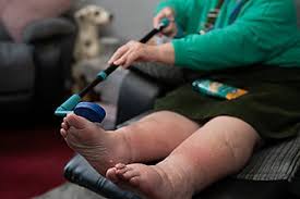 Image result for Pedistylis