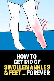 How To Get Rid Of Swollen Ankles Feet How To Get Rid Health And Beauty Tips Swollen Ankles