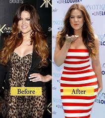 Khloé kardashian recently stole headlines after trimming her waist, toning her legs and looking overall radiant and healthy. Revealed How Khloe Kardashian Lost 40 Pounds
