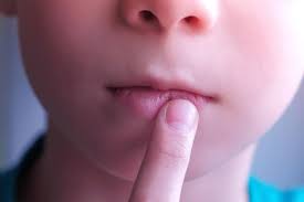 Herpes Im Mund Ursachen Und Die Besten Tipps Brigitte De