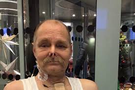 Fundraiser by Madeleine Bengtsson : Severe septic shock has left my father  limbless.