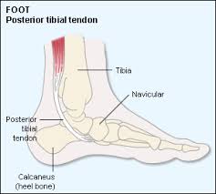The foot consists of thirty three bones, twenty six joints and over a hundred muscles, ligaments and tendons. Posterior Tibial Tendon Injury Mydr Com Au