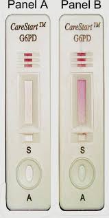 Image result for G6PD Deficiency Detection