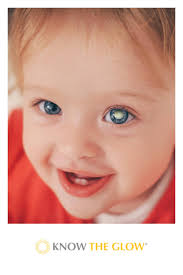 Know The Glow (@Know_The_Glow)