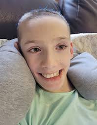 Could Deep Brain Stimulation Alleviate Symptoms for This Rare Neurological  Disorder?