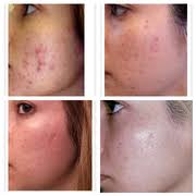 EVE & ADAM SUGARING STUDIO