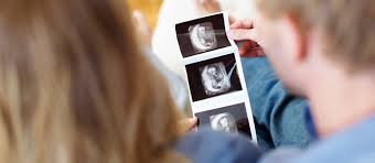 Le taux de l'hormone de grossesse hcg est à son maximum, ce qui peut te rendre sujette. Le Developpement De L Embryon Et Du Foetus 1er Trimestre