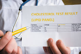 Total cholesterol is a measurement of both good and bad cholesterol. Low Ldl And Stroke A Closer Look Harvard Health