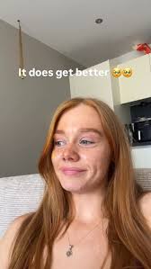 It gets better guys 🌹