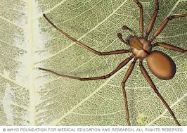 If you didn't see the spider bite you, then the chance that it's an actual spider bite is pretty slim. Spider Bites Symptoms And Causes Mayo Clinic
