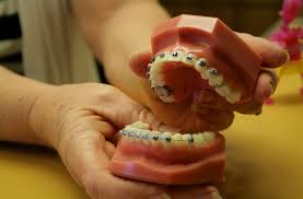 Check spelling or type a new query. 10 Recommendations For Reducing Braces Pain Beautiful Smiles Family Dental Center