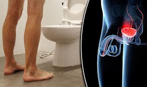 Bladder cancer is usually treatable when caught at an early stage but more challenging to address when found later. Bladder Cancer Symptoms Revealed Seven Signs You Could Have The Disease Express Co Uk