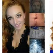 Ostomy Surgery Saved Matthew Perry's Life. It's Time to Stop the Stigmas.