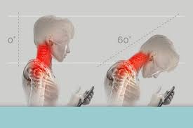 The neck is the start of the spinal column and spinal cord. Tips To Prevent Tech Neck And Other Pain From Technology Use