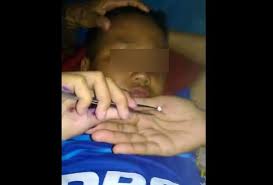 Kenali semut masuk yang masuk ke lubang telinga, apakah bagian kanan atau kiri telinga. Viral Telinga Bocah Di Majalengka Ini Dipenuhi Semut Potongan Kertas Okezone News