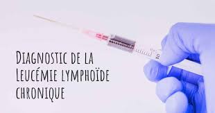 Leucémie lymphoïde chronique, épidémiologie, clinique, biologie, pronostic, togo. Comment La Leucemie Lymphoide Chronique Est Elle Diagnostiquee