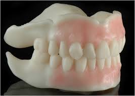 Check spelling or type a new query. Intraoral Scanning To Fabricate Complete Dentures With Functional Borders A Proof Of Concept Case Report Bmc Oral Health Full Text