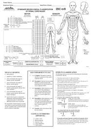 Image result for Spinal Trauma