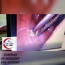 Check spelling or type a new query. Klinik Anda Cheras Balakong 24jam Home Facebook