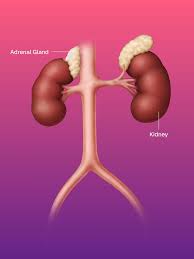 Image result for Hyperaldosteronism