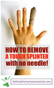 Tiny painless slivers should be removed as soon as possible to prevent infections or before a swelling arises. How To Remove A Splinter Without A Needle Healthy Home Economist