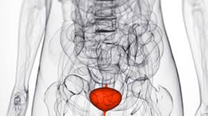 Can bladder cancer be cured? What Every Woman Should Know About Bladder Cancer A Womans Health
