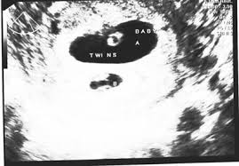 Give it a week or so and you'll have a better idea. Twins At 6 Weeks What S Like In Ultrasound Pictures New Kids Center