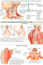 Image result for Winged Scapula