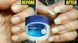 Grow Long Strong Nails Overnight At Home Nail Growth Serum 100 Works Must Try Youtube Strong Nails How To Grow Nails Strong Nails Diy Remedies