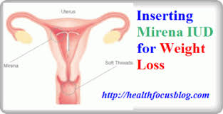 Pin On Healthfocusblog
