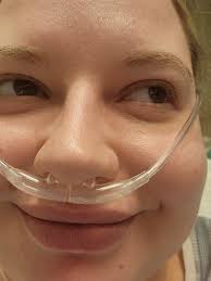 TW: Post surgery pictures 5 days post op from top surgery. Still pretty  swollen but still super happy it's been a long wait.