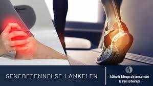 Den fungerer bra nå men jeg kan ikke se at hevelsen er blitt mindre de siste to ukene. Senebetennelse I Ankelen Raholt Kiropraktorsenter Fysioterapi