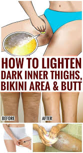 How To Get Rid Of Dark Inner Thighs Naturally Bikini Area Lighten Inner Thighs Lighten Bikini Area