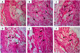 Image result for Flabellaria paniculata