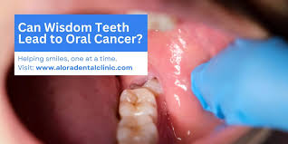 Image result for dental cancer