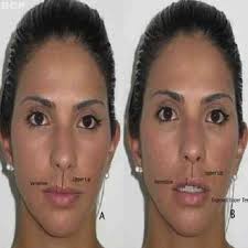 Measurements, clockwise from left: nasal projection (Sn-P), lower face...