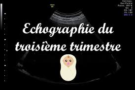 En si?ge comment l'aider ? Echographie Du Troisieme Trimestre P Tite Bouille