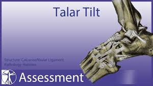 Image result for Talar Tilt
