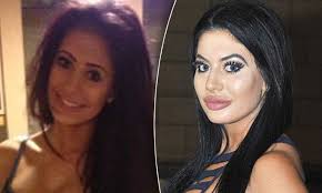 See more of chloe ferry on facebook. Geordie Shore S Chloe Ferry Plans For More Cosmetic Surgery Daily Mail Online