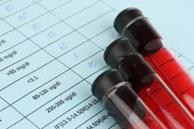 Blood Thinners Linked To Increased Hematuria Complications Study Aboutlawsuits Com